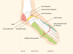 Hallux valgus